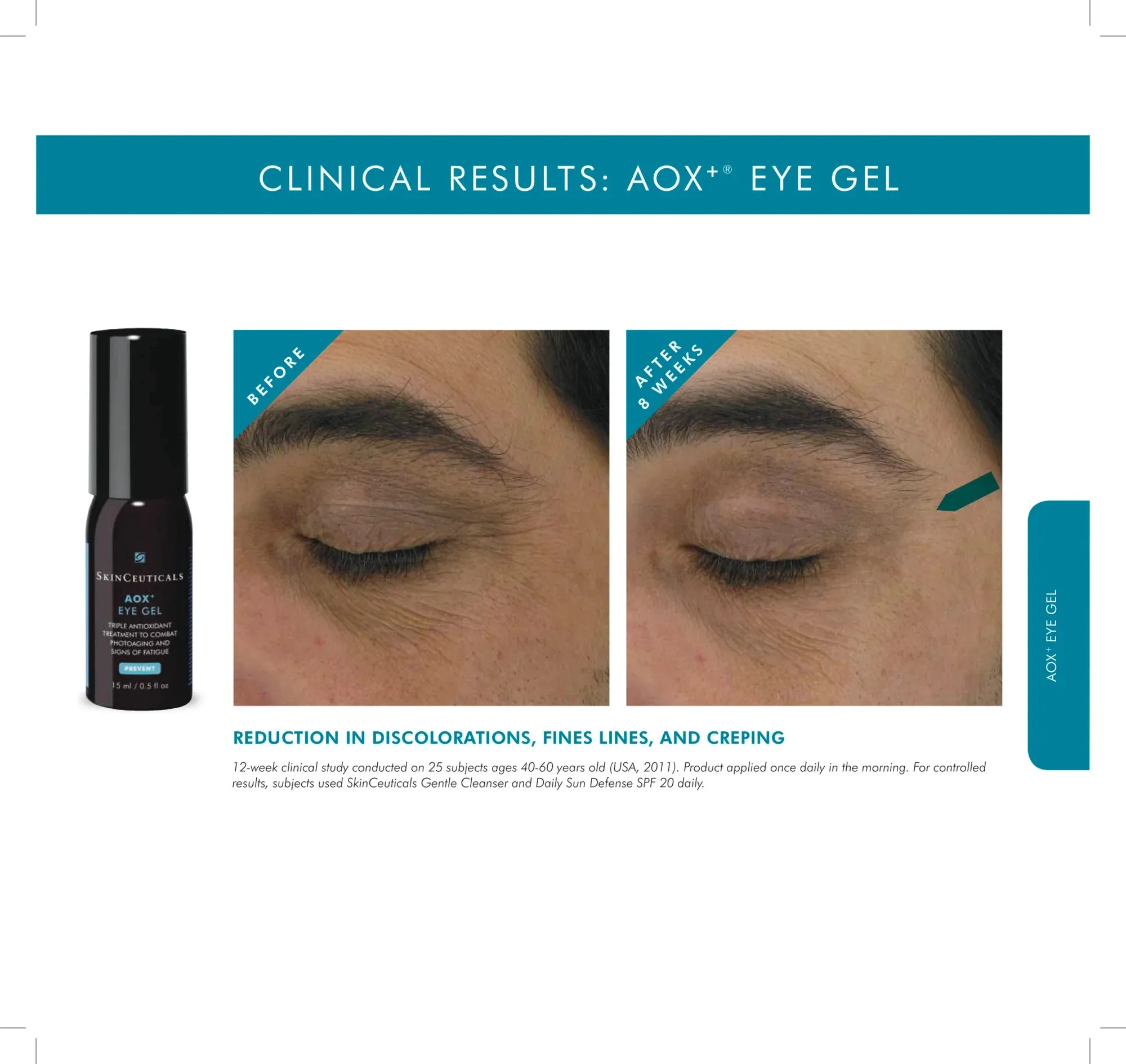 SkinCeuticals AOX  Eye Gel